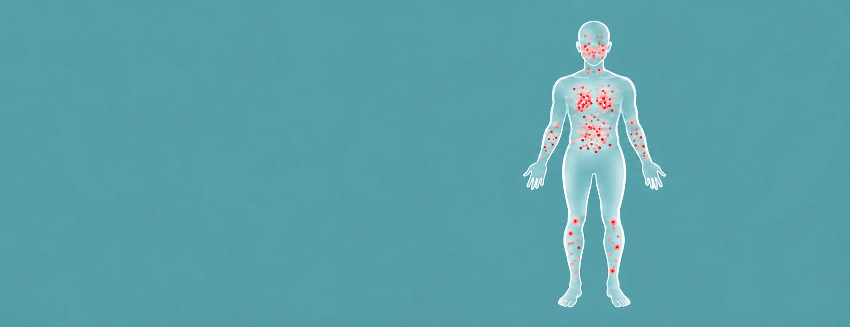 Illustrated diagram of a generic human silhouette showing chickenpox rash distribution, with dots concentrated on the trunk, chest and face, sparse on the lower arms and legs